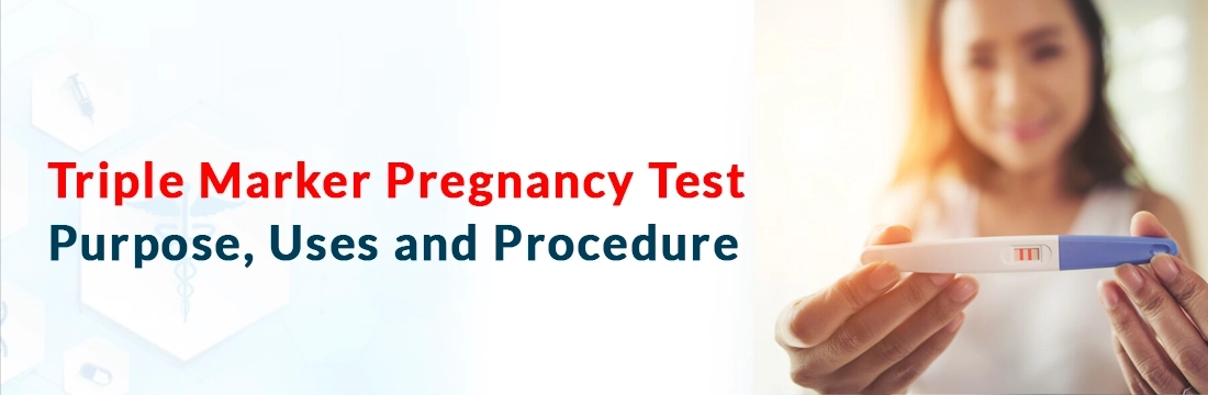  Triple Marker Pregnancy Test: Purpose, Uses and Procedure